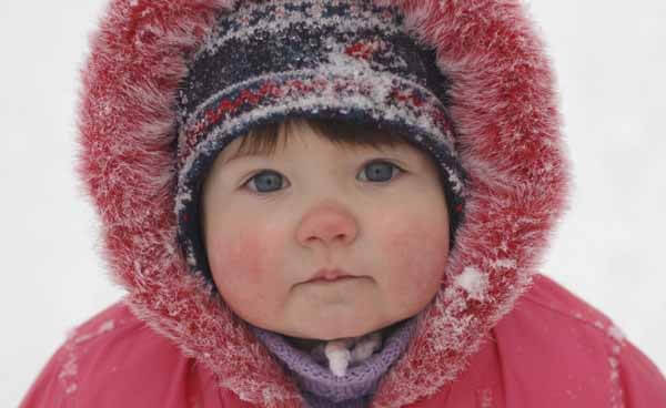 Аллергия на холод у ребенка фото